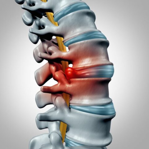 Symptoms and Treatments for Thoracic Spine Conditions