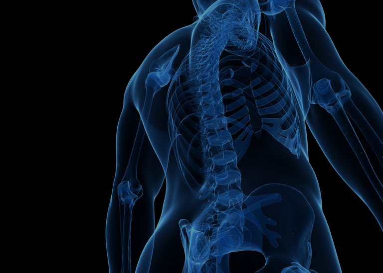 How to Overcome Chronic Neck Pain Without Surgery - Desert Institute for  Spine Care